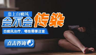 白癜风有没有传染性