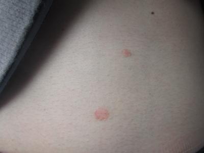 牛皮鲜要怎么办才能好