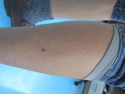 ΪʲôţƤѢ·´¸´³öÏÖÄØ