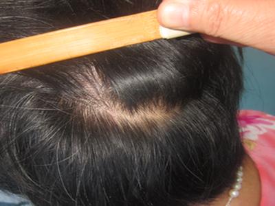 银消灵功效与作用