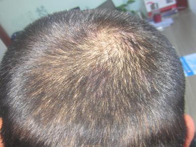 ţƤѢͼƬ ţƤѢÖÎÁÆÍ¼Æ¬