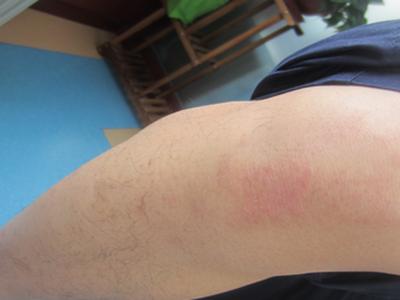 ţƤѢΪʲôÕâôÄÑÒ½ÖÎ