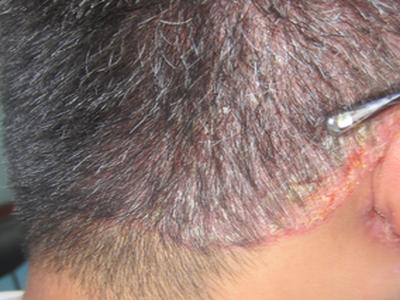 周口看牛皮癣好的医院在哪